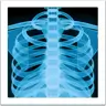 Röntgenbild Emoji 🩻 image - Apple style